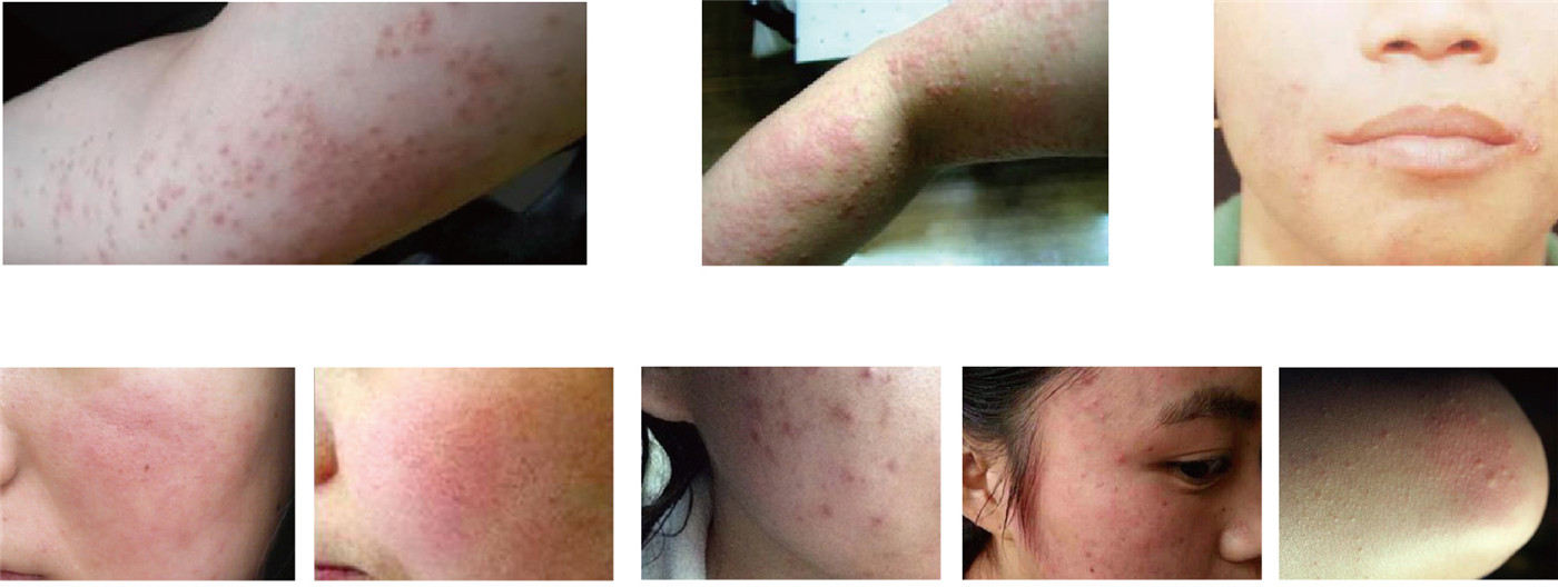 Irritability Skin Disease center