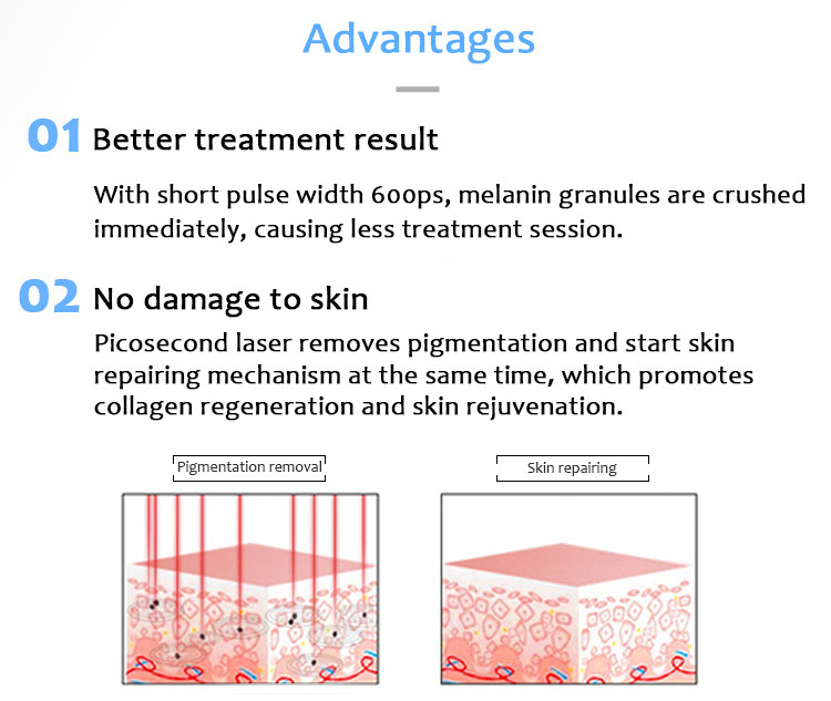 1064pvyl+ High Quality 1064nm & 532nm PicolaserPicosecond Laser Tattoo Removal Pigmentation Luxurious Equipment (6)