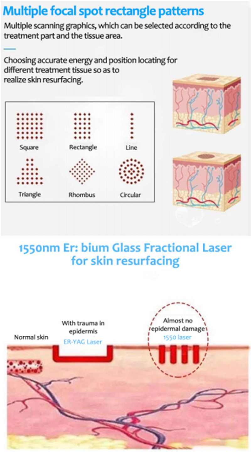 1550KK er bium glass fractional laser for distributor (4)