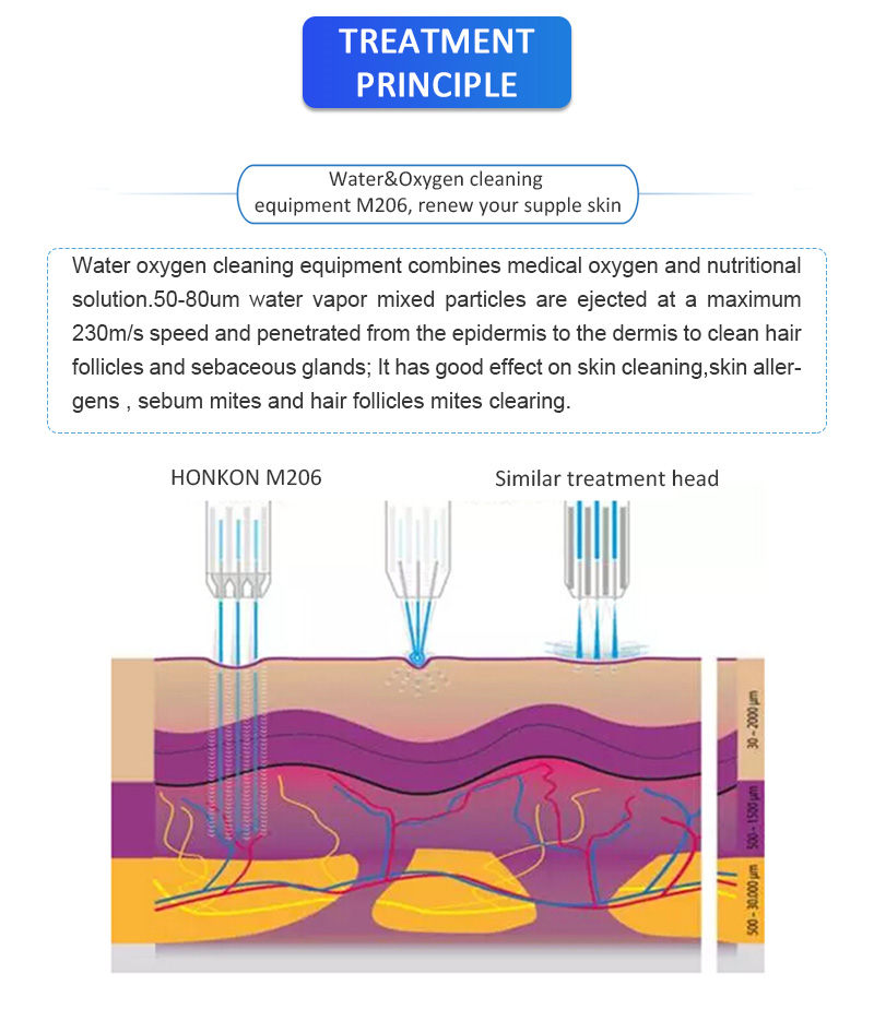 Applications 1. Acne clearance; 2. Skin whitening,skin texture improving; 3. Deeply skin cleaning,replenishing water and nutrition for skin; 4. Folliculitis; 5. Combined with other equipments to achieve a better treatment effect;     特征和优势：Features & Advantages 1. M206 is cost effective as a vertical Water & Oxygen Jet machine; 2. Unique inner air supply system guarantees the security and stability of air output; 3. Air output adjustment system accurately controls the output flow and pressure of liquid for different treatment parts; 4. Air switch easily transfers air supply from Air Compressor or Medical Oxygen Tank; 5. The inner Air Compressor can offer 0-10KG air output pressure to meet the need of treatment; 6. Being natural, healthy and fresh, Water & Oxygen Jet treatment replenishes the skin with oxygen and nutrients, and gives you a clean and young skin;