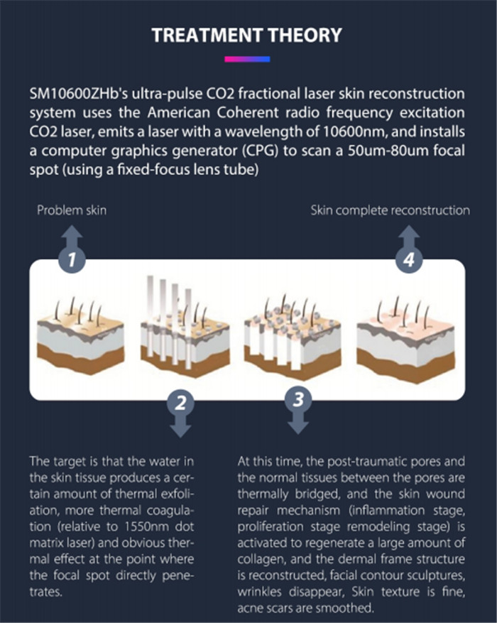 60watt Coherent CO2 fractional laser SM10600ZHb Skin Resurfacing Anti-Aging Scar Removal Vaginal Tightening (3)