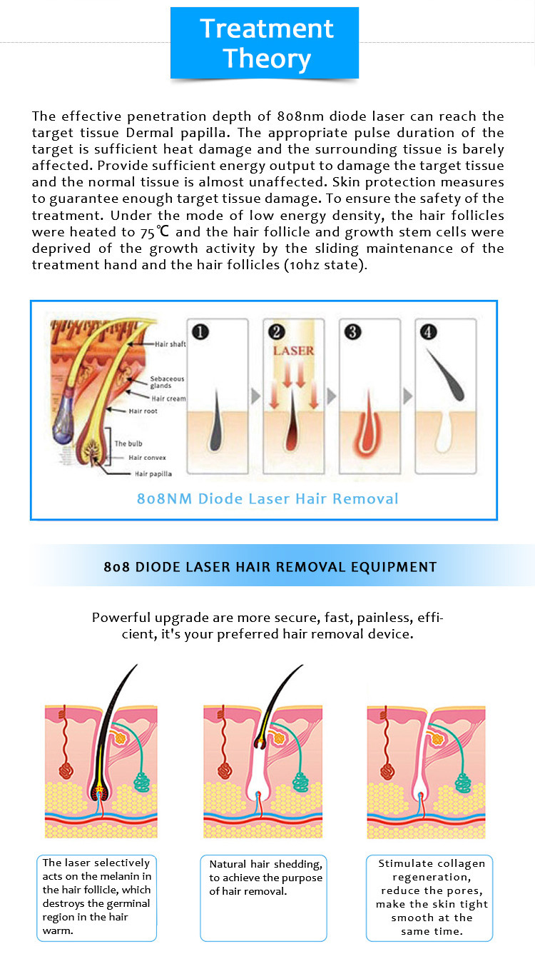 808AL-01 HONKON 808nm Diode Laser Permanent Hair Removal Machine (2)
